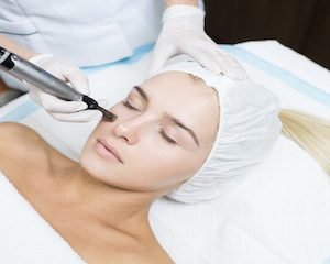 skin needling collagen therapy huntington beach cosmetic ink artistry
